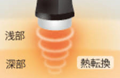 超音波