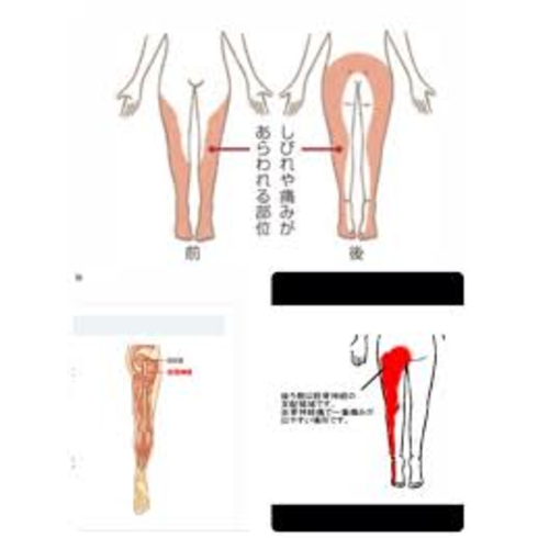 骨格